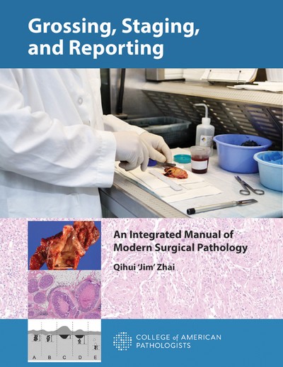 Lumpectomy  Gross Pathology Manual